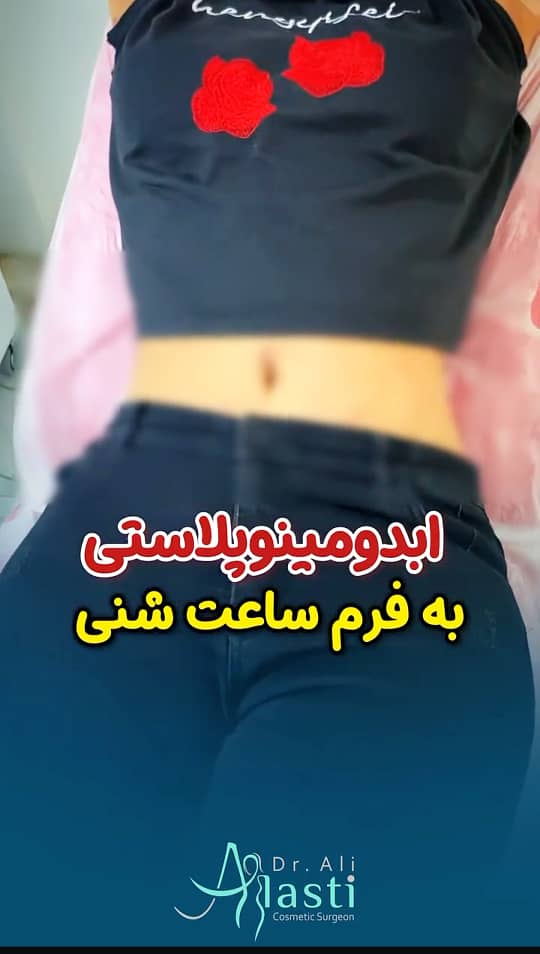 ابدومینوپلاستی