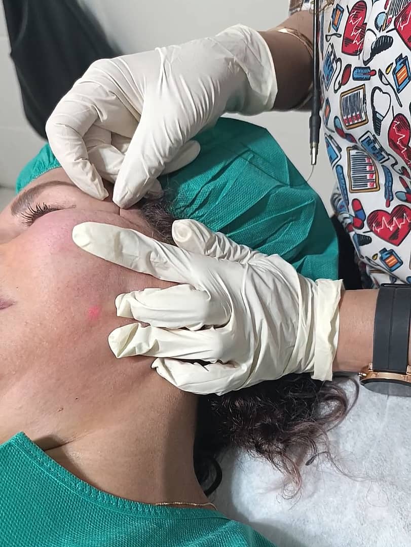 اندولیفت دکتر پورجم