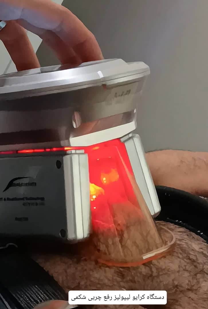 لاغری با دکتر پورجم