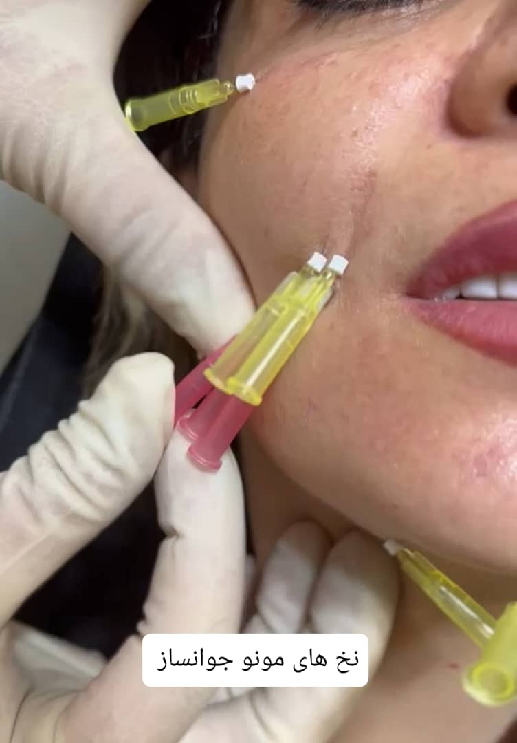 نخ جوانسازی